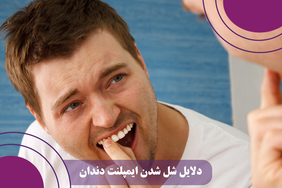 چرا دندان ایمپلنت لق میشود