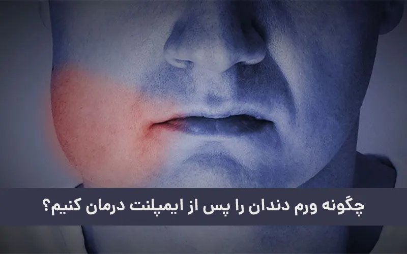 برای ورم ایمپلنت چه باید کرد