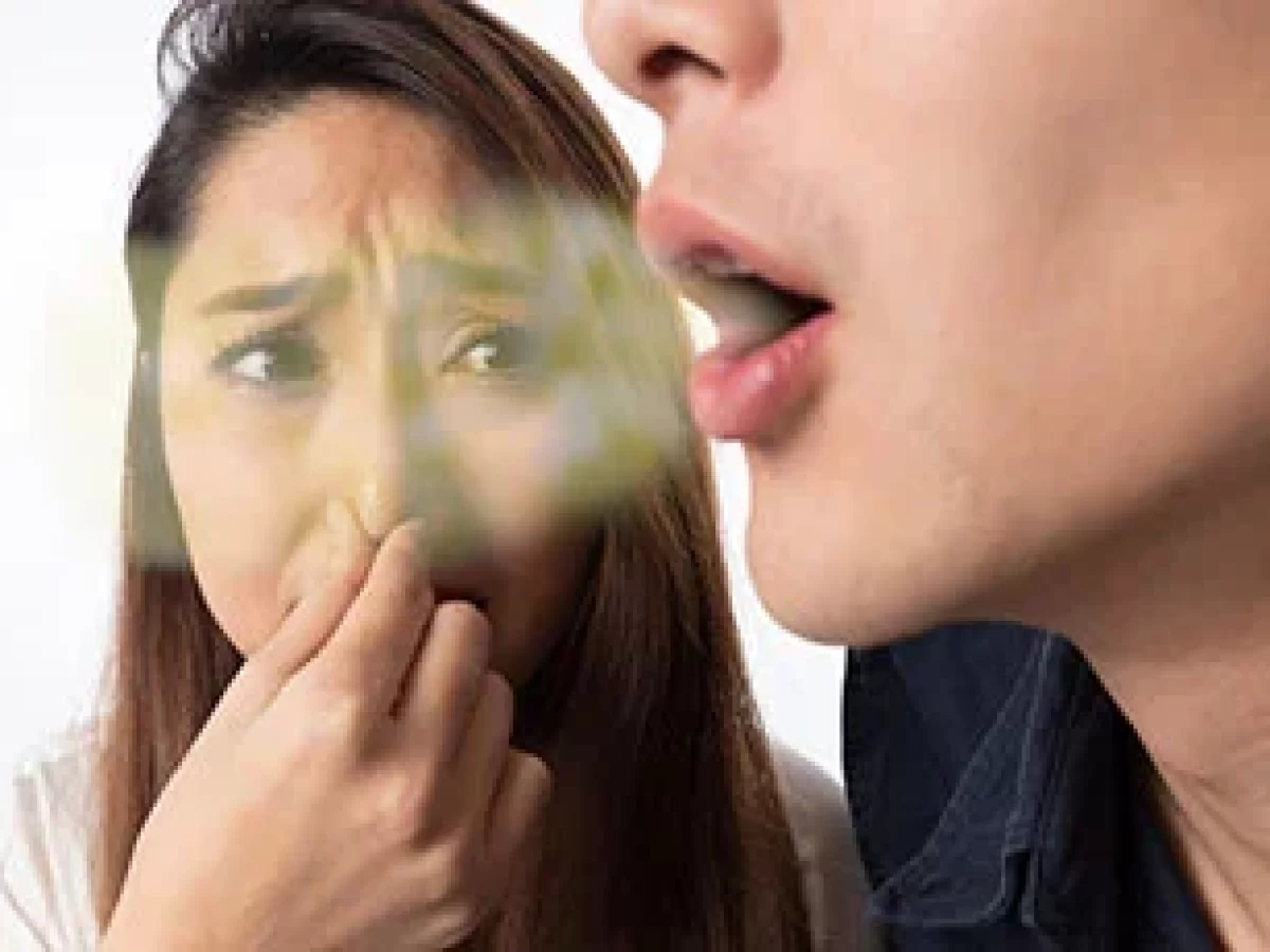 ایا لمینت دندان باعث بوی بد دهان میشو