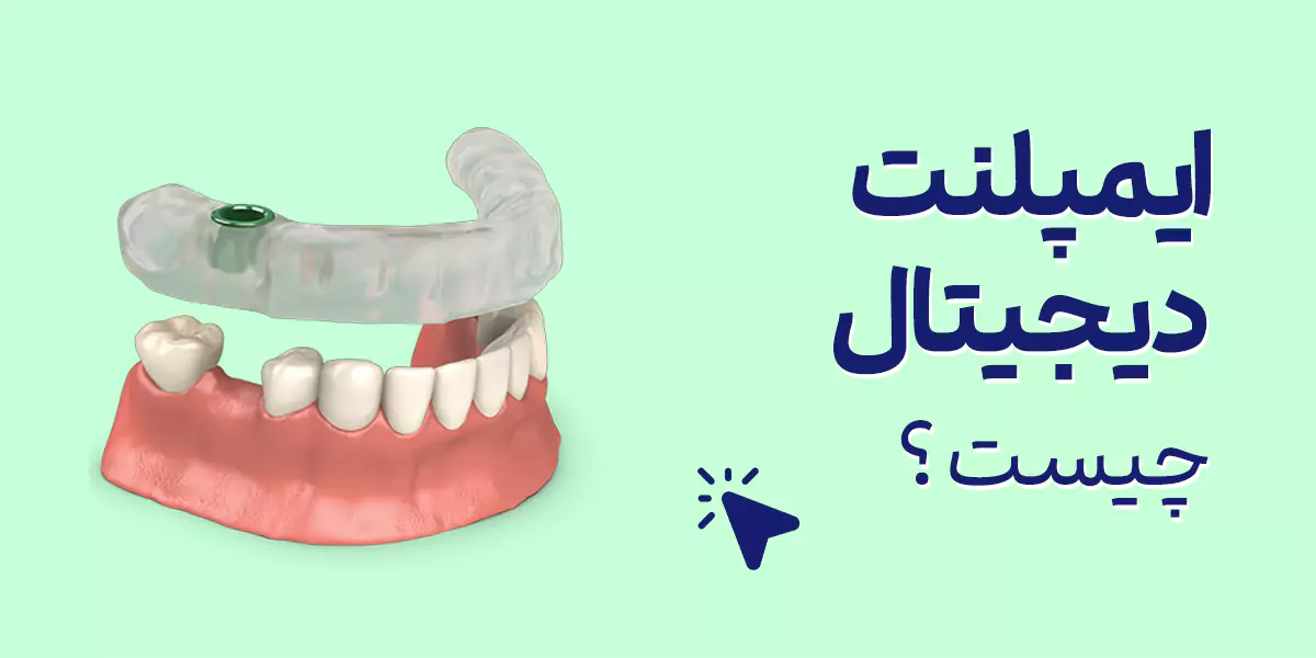 آیا ایمپلنت دیجیتال درد دارد؟