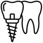 ایمپلنت اقساطی